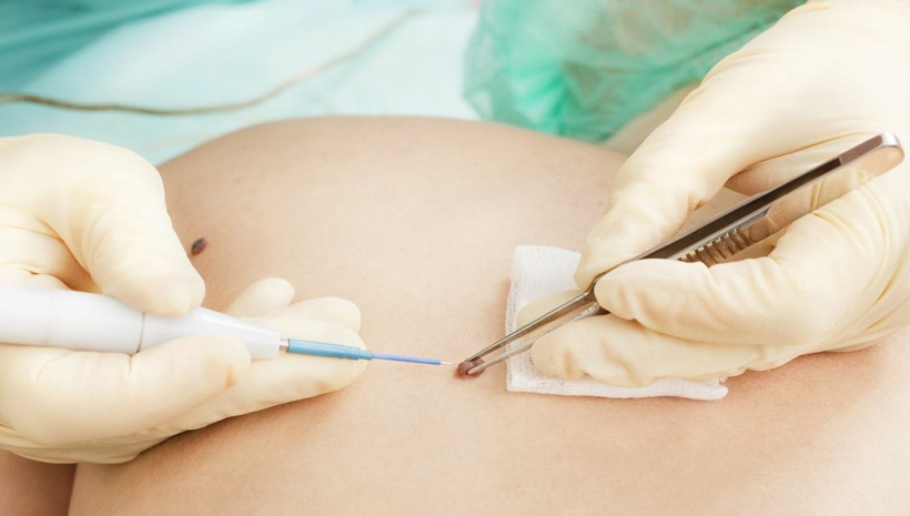 Gynecological Clinic